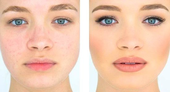 Перманентный макияж губ фото до и после