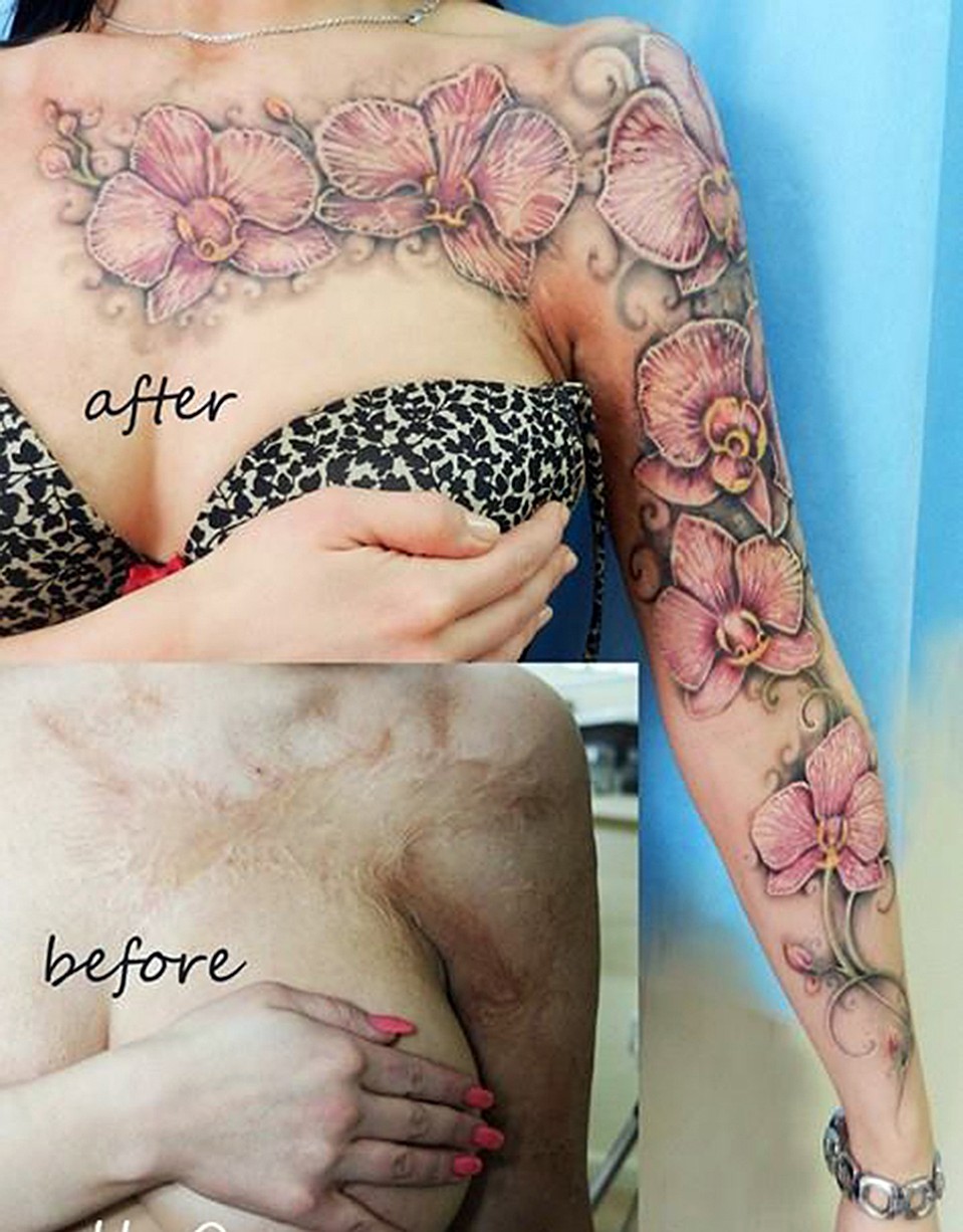 Если татуировку набивает опытный мастер, то она не только перекроет шрам, но и скрасит его. Фото: соцсети. 