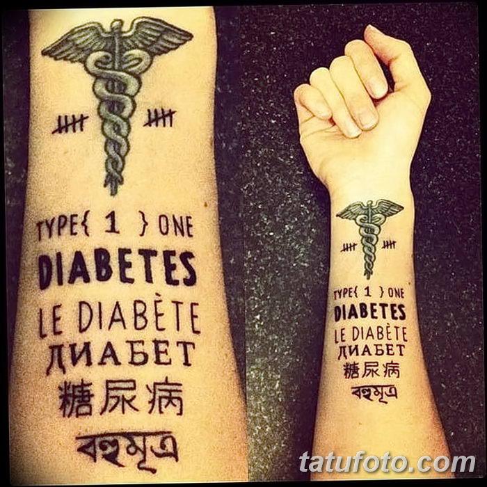 фото Медицинские тату от 22.04.2018 №055 - Medical Tattoo - tatufoto.com